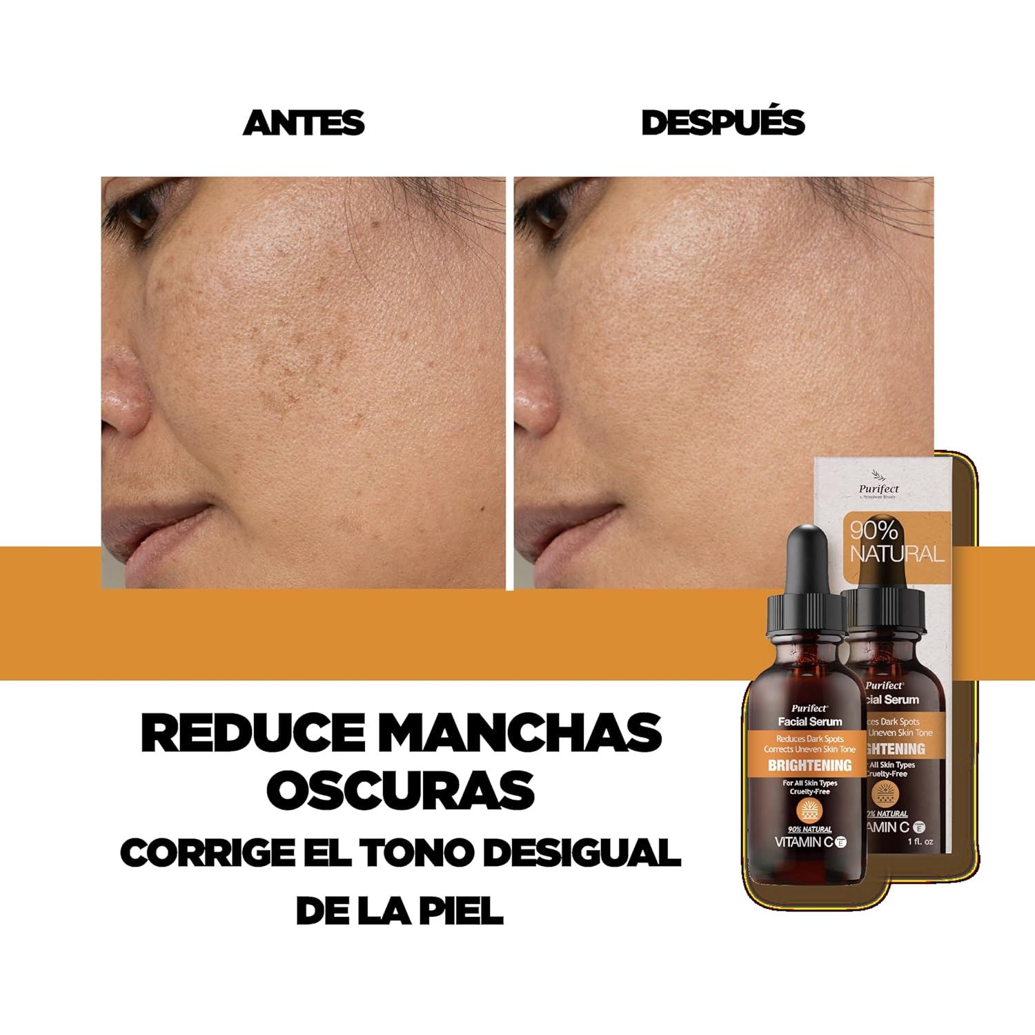 Brightening Vitamin C Serum – Improves Dark Spots & Uneven Skin Tone (30ml)